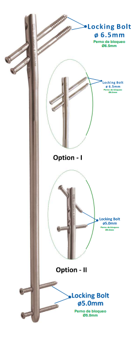 DAKSH Multi Femur Nail Right